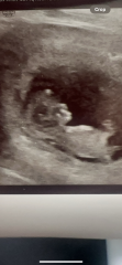 Scan head shape concern