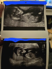 12+6 scan- for fun!