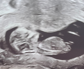 Nub theory “experts” have guessed opposite sex
