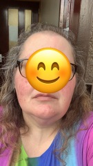 What to do with my thin hair (wigs? shave it?)...