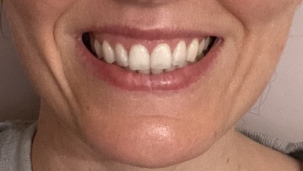 What do I need to get a nicer face?
