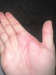 Does anyone know what happened to my hand?