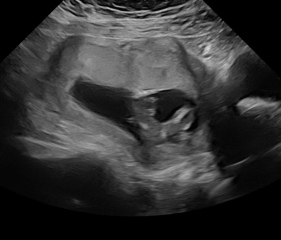 Confirmed gender?