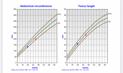 Placental insufficency at 26 weeks