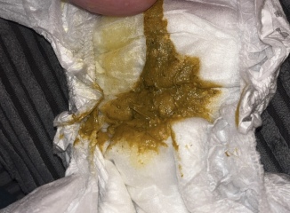 ? Normal poo on apatmil pepti