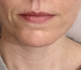What do I need to get a nicer face?
