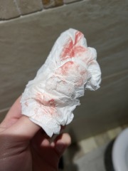 TRIGGER WARNING POTENTIAL IMPLANTATION BLEED - ADVICE NEEDED PLEASE