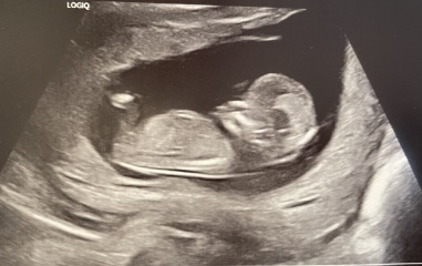 Boy or girl?