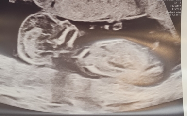 Boy or girl?
