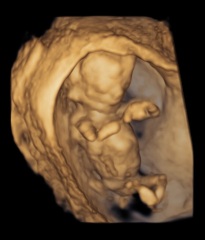Boy or Girl? 12 week scan