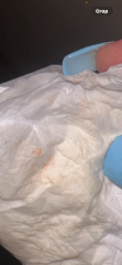 Implantation bleeding?