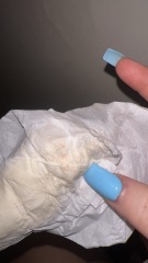 Implantation bleeding?