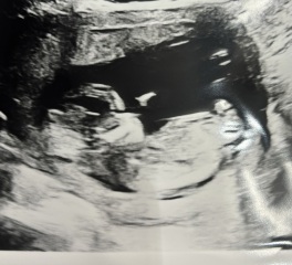 Can a 17 week boy gender scan be wrong?