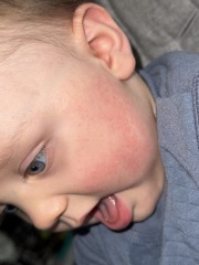 Is this a possible allergy?