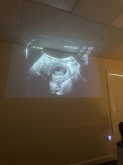 Any guesses on gender from my ultrasound? X