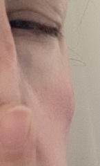 Wanna see my face lump?