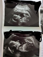 Gender of scan images