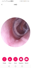 Bought an ear camera PICS