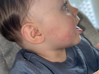 Is this a possible allergy?