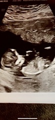 Girl or boy??