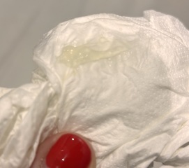 Lost mucus plug (pics enclosed TW)