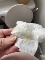 Mucus plug 37 weeks