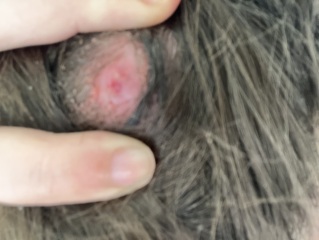 I think I have a cyst on top of my cyst (pics)
