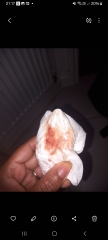 *TMI PHOTOS* Help - implantation bleeding?