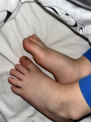 Does this warrant a&e, infected toe?