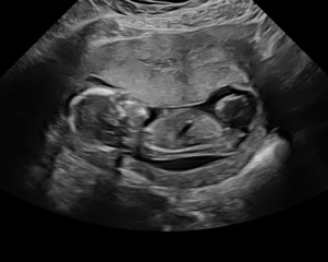 Confirmed gender?