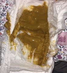 Normal poo or too runny?