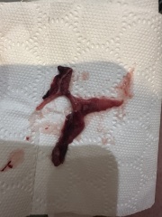 Am I having another miscarriage?