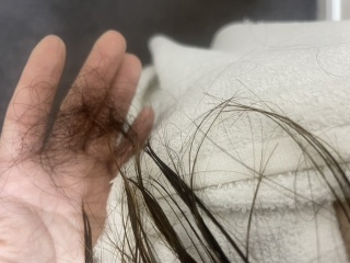 Emergency! Hair falling!!!