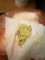 Formula fed baby poo