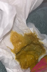 ? Normal poo on apatmil pepti