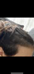 Which (probably) overpriced over-hyped supplement should I buy to help my thinning hair grow?