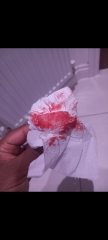 *TMI PHOTOS* Help - implantation bleeding?