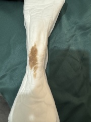What’s this brown spotting mean?