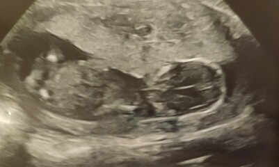 12 week nub theory guesses!!