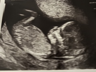 Any guesses?