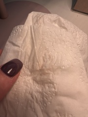 Little blood in discharge - 4 weeks pregnant