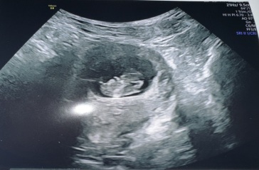 Any guesses on gender from my ultrasound? X