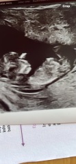 Girl or boy??