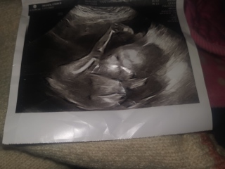 Gender prediction? ❤️