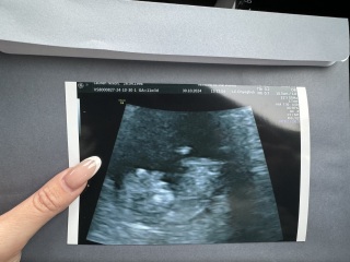 Any gender guesses now nub is visable? 11 weeks 3 days xx