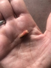 Any idea what this could be...GROSS PIC INCLUDED