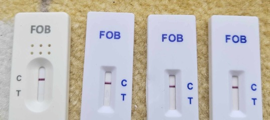 Should FIT test result show the result values?