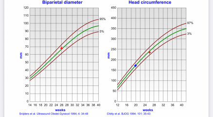 Placental insufficency at 26 weeks