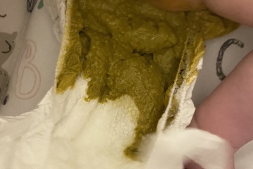 Kendermil - poo check