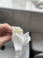 Mucus plug 37 weeks